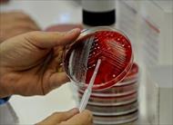 گزارش کار آزمایشگاه با عنوان کشت میکروب و تشکیل کلنی